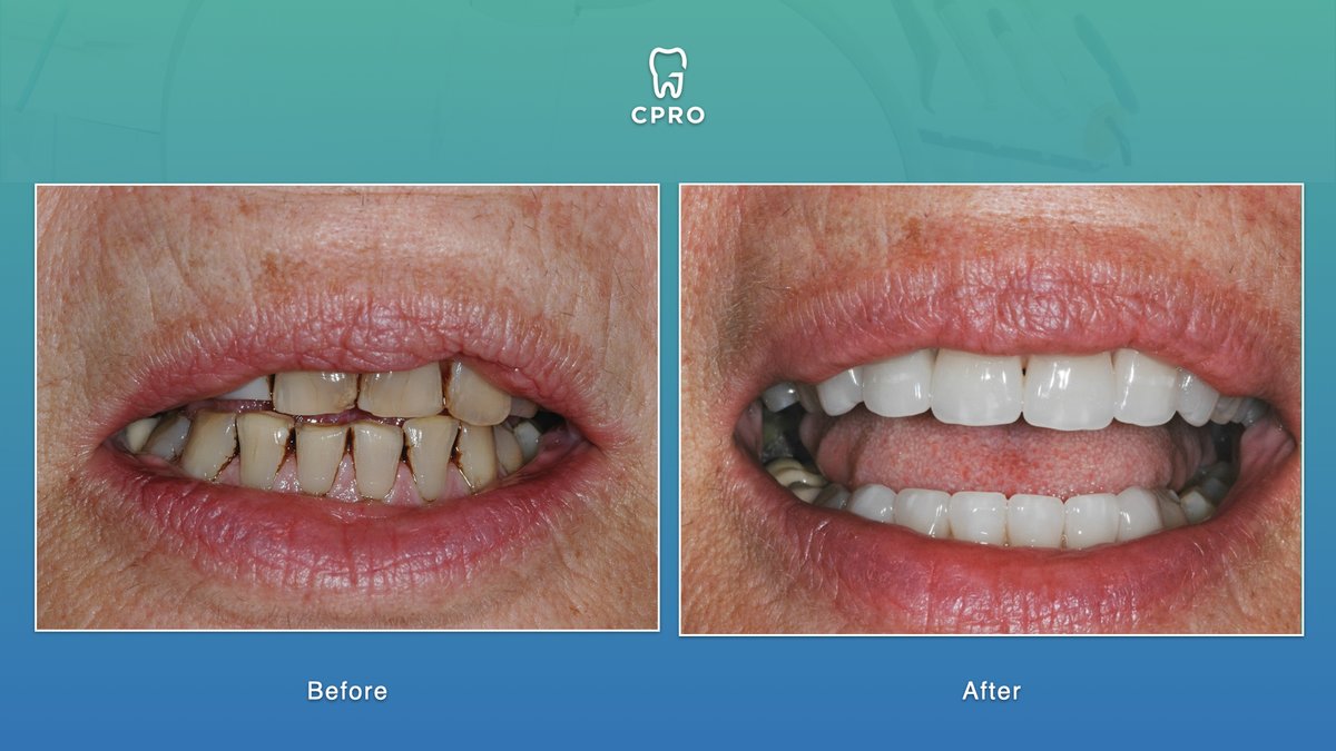 CPRO Clinic -Oral Prevention and Dental Rehabilitation Clinic - CPRO Clinic -Oral Prevention and Dental Rehabilitation Clinic