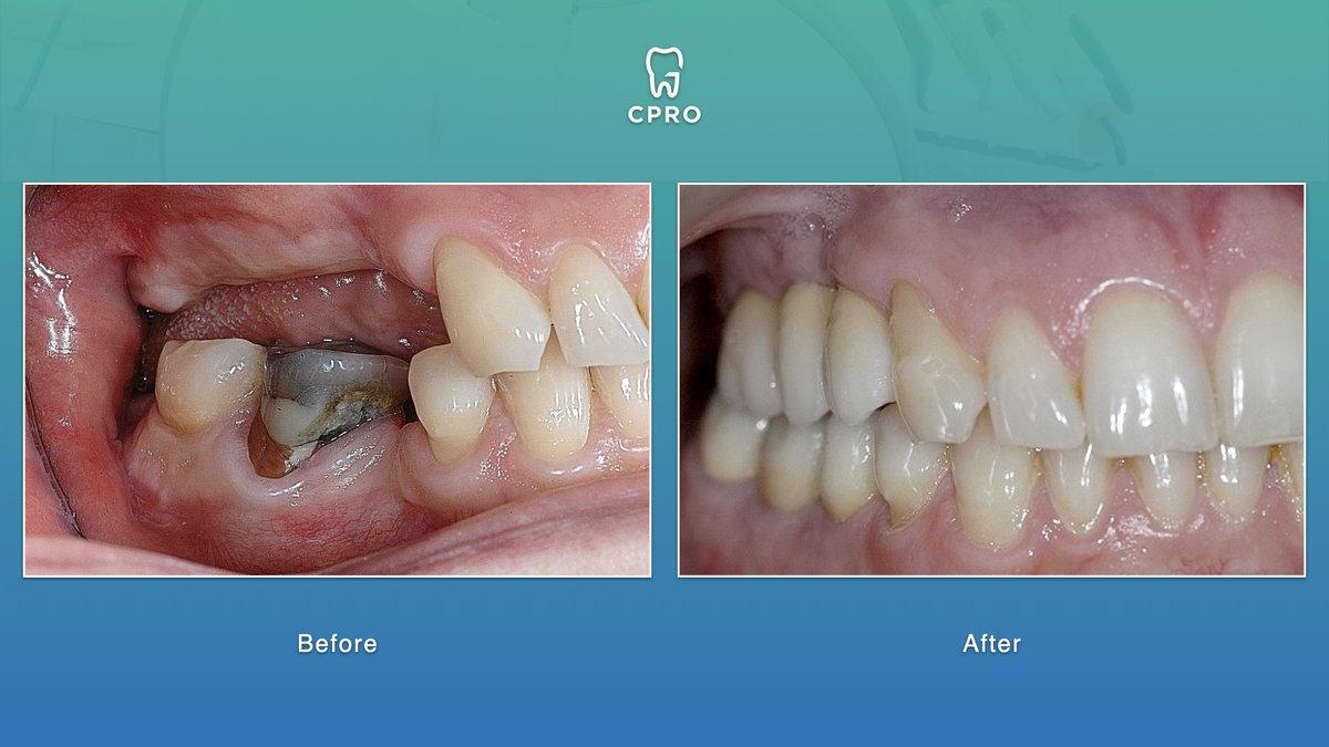 CPRO Clinic -Oral Prevention and Dental Rehabilitation Clinic - CPRO Clinic -Oral Prevention and Dental Rehabilitation Clinic