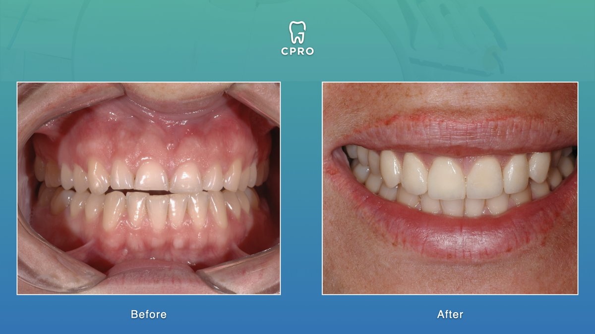 CPRO Clinic -Oral Prevention and Dental Rehabilitation Clinic - CPRO Clinic -Oral Prevention and Dental Rehabilitation Clinic