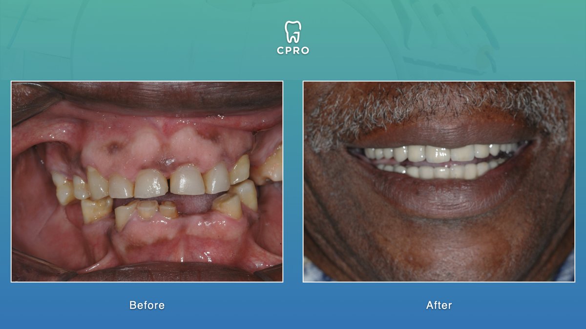 CPRO Clinic -Oral Prevention and Dental Rehabilitation Clinic - CPRO Clinic -Oral Prevention and Dental Rehabilitation Clinic