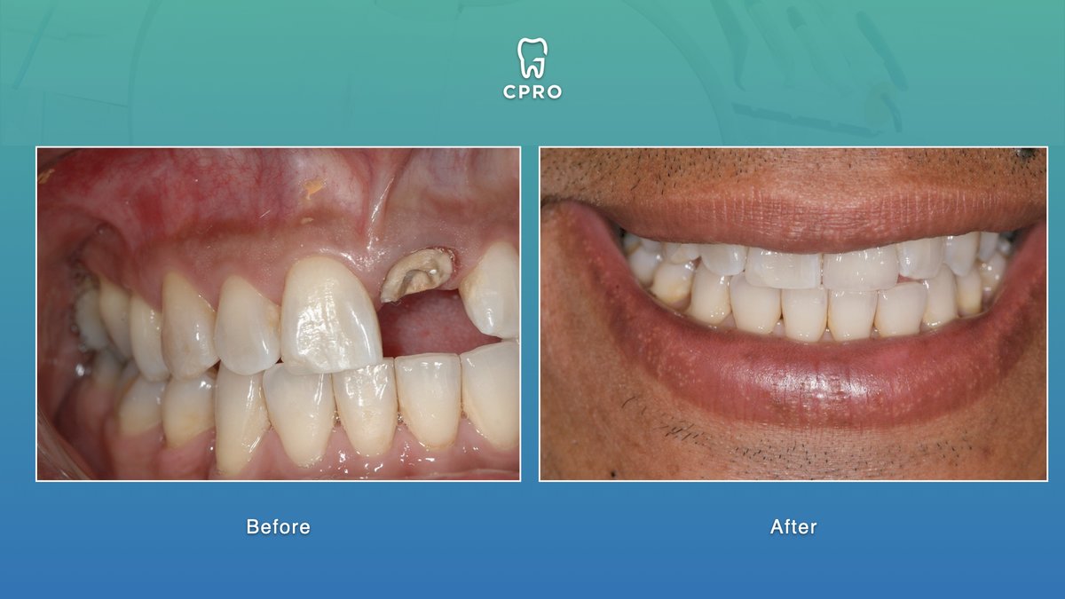 CPRO Clinic -Oral Prevention and Dental Rehabilitation Clinic - CPRO Clinic -Oral Prevention and Dental Rehabilitation Clinic