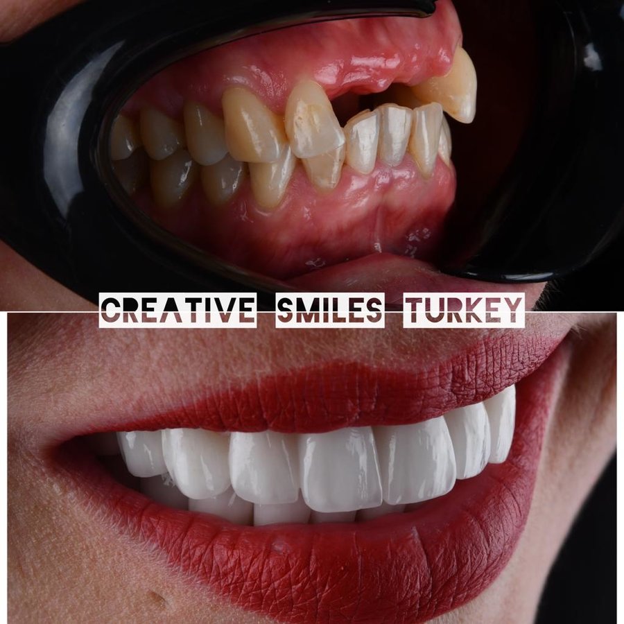 Creative Smiles Turkey - Creative Smiles Turkey
