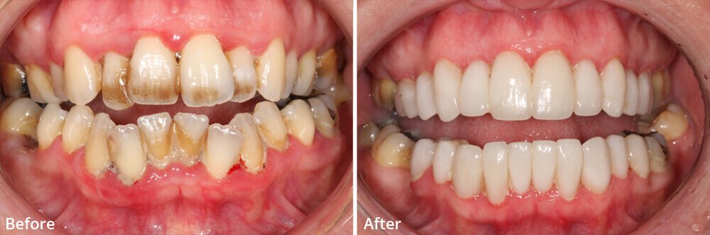 Crown Dental Solutions - Crown Dental Solutions