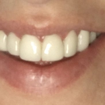 Crystal Dental Care - Crystal Dental Care