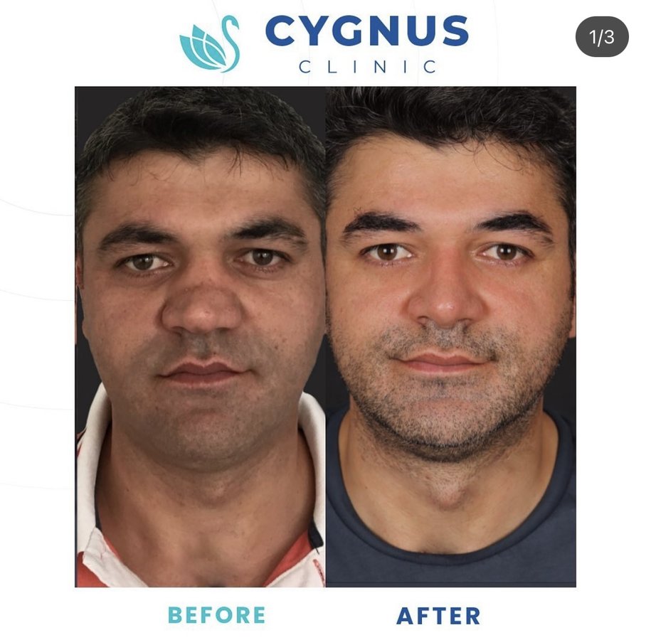 Cygnus Clinic - Cygnus Clinic