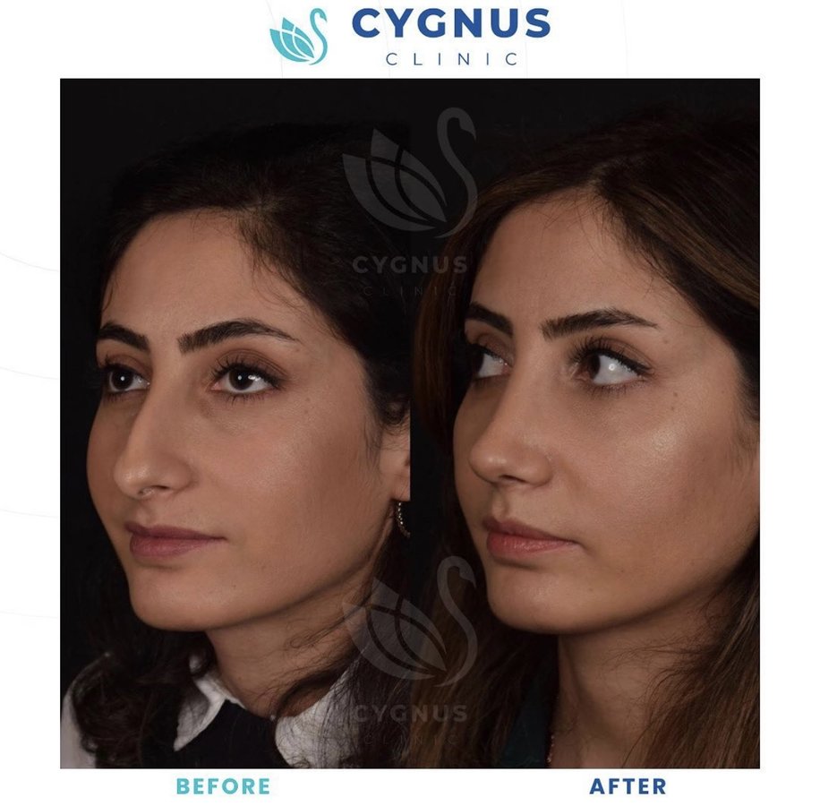 Cygnus Clinic - Cygnus Clinic