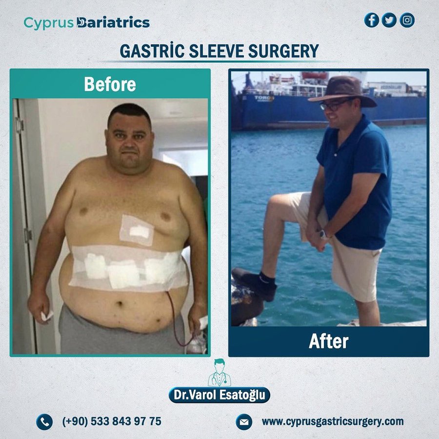 Cyprus Bariatrics - Dr. Varol Esatoglu - Cyprus Bariatrics - Dr. Varol Esatoglu