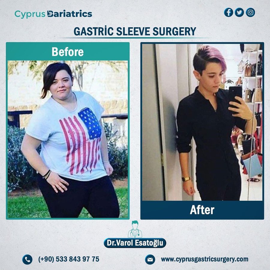 Cyprus Bariatrics - Dr. Varol Esatoglu - Cyprus Bariatrics - Dr. Varol Esatoglu