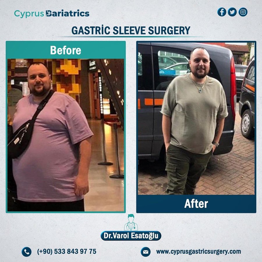 Cyprus Bariatrics - Dr. Varol Esatoglu - Cyprus Bariatrics - Dr. Varol Esatoglu