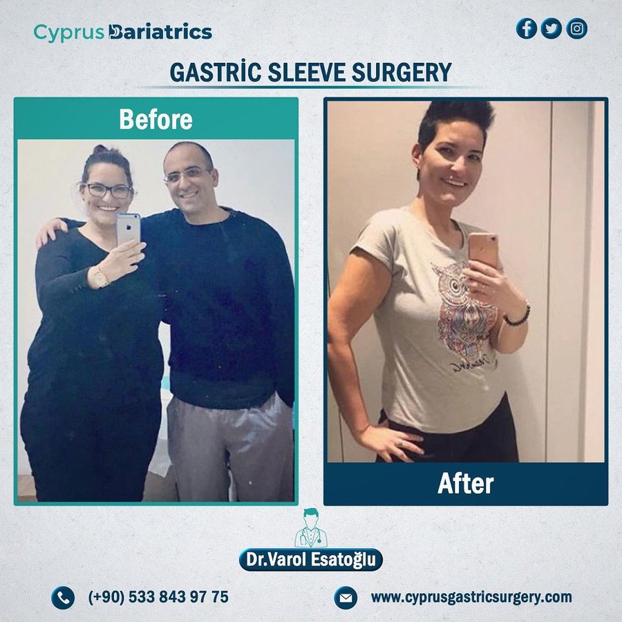 Cyprus Bariatrics - Dr. Varol Esatoglu - Cyprus Bariatrics - Dr. Varol Esatoglu
