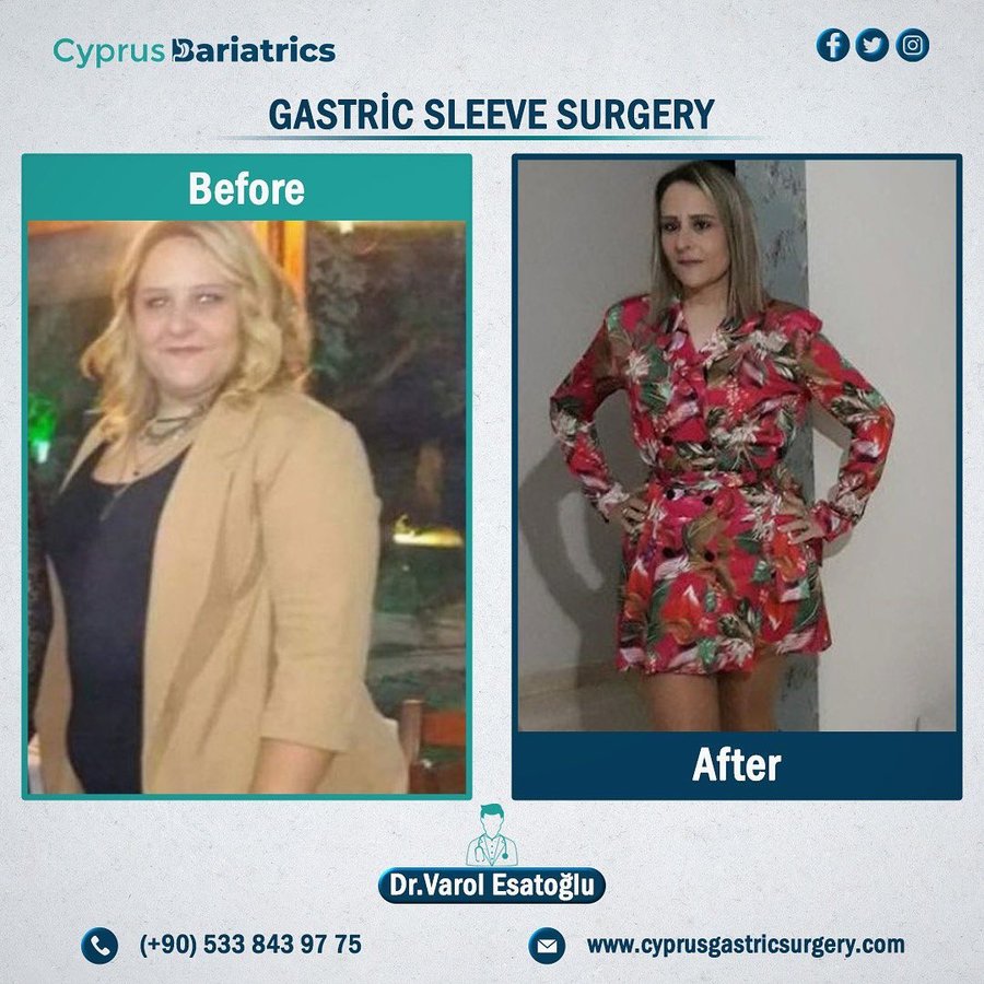 Cyprus Bariatrics - Dr. Varol Esatoglu - Cyprus Bariatrics - Dr. Varol Esatoglu