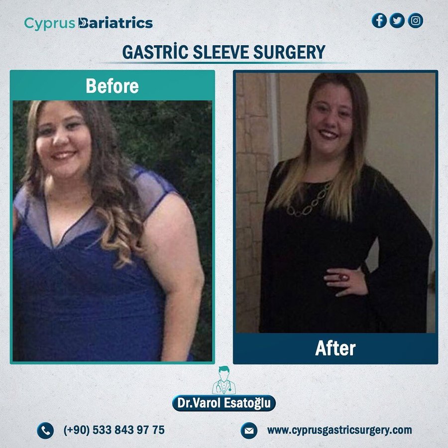 Cyprus Bariatrics - Dr. Varol Esatoglu - Cyprus Bariatrics - Dr. Varol Esatoglu