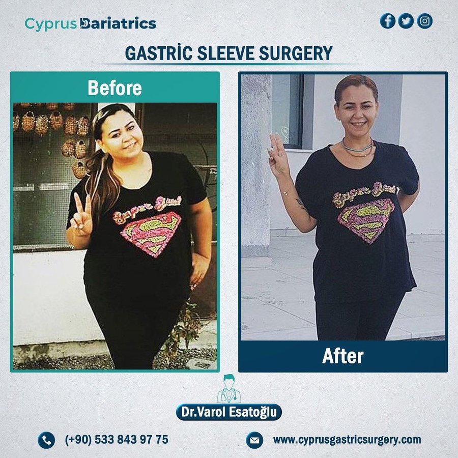 Cyprus Bariatrics - Dr. Varol Esatoglu - Cyprus Bariatrics - Dr. Varol Esatoglu