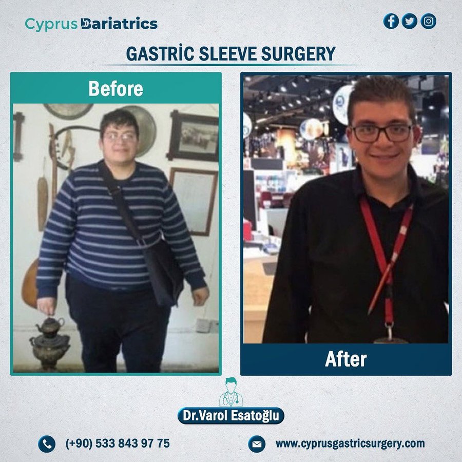 Cyprus Bariatrics - Dr. Varol Esatoglu - Cyprus Bariatrics - Dr. Varol Esatoglu