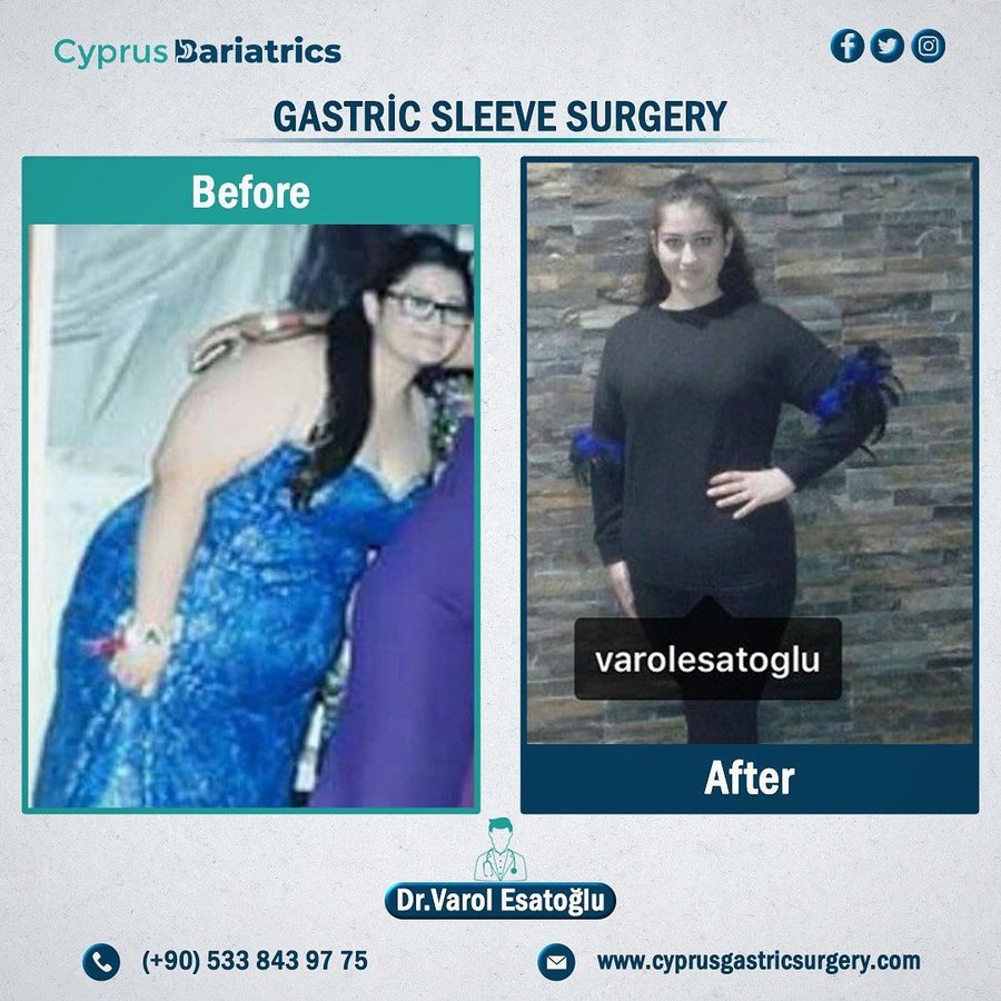 Cyprus Bariatrics - Dr. Varol Esatoglu - Cyprus Bariatrics - Dr. Varol Esatoglu