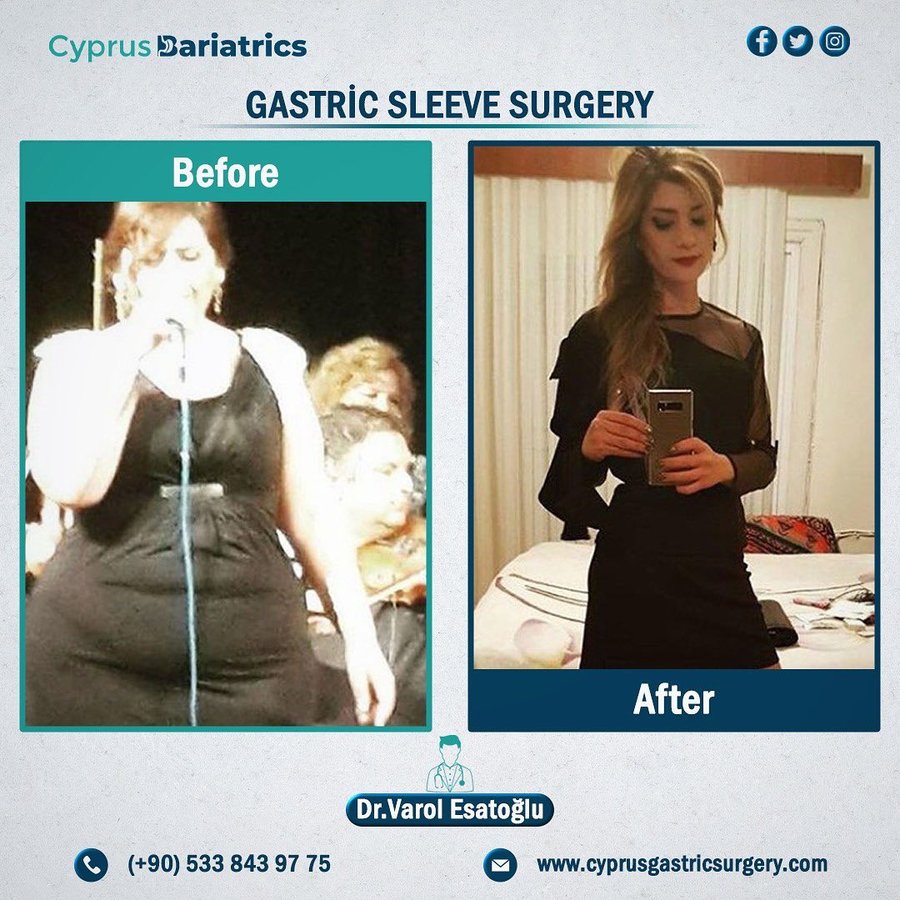 Cyprus Bariatrics - Dr. Varol Esatoglu - Cyprus Bariatrics - Dr. Varol Esatoglu