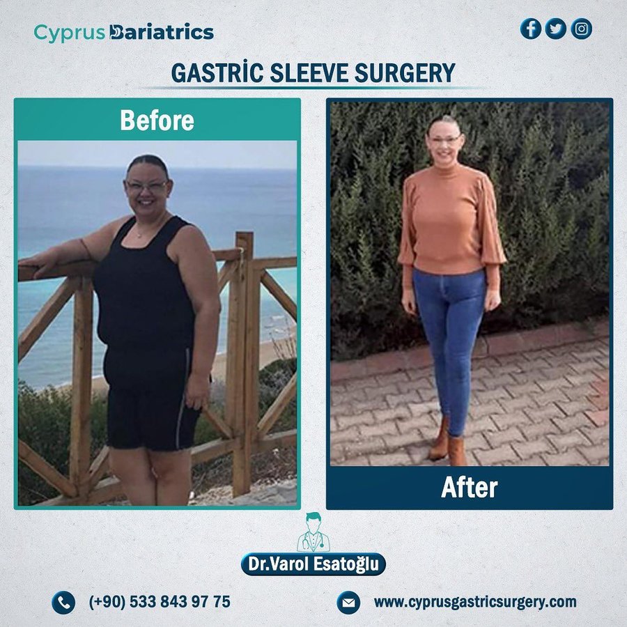 Cyprus Bariatrics - Dr. Varol Esatoglu - Cyprus Bariatrics - Dr. Varol Esatoglu