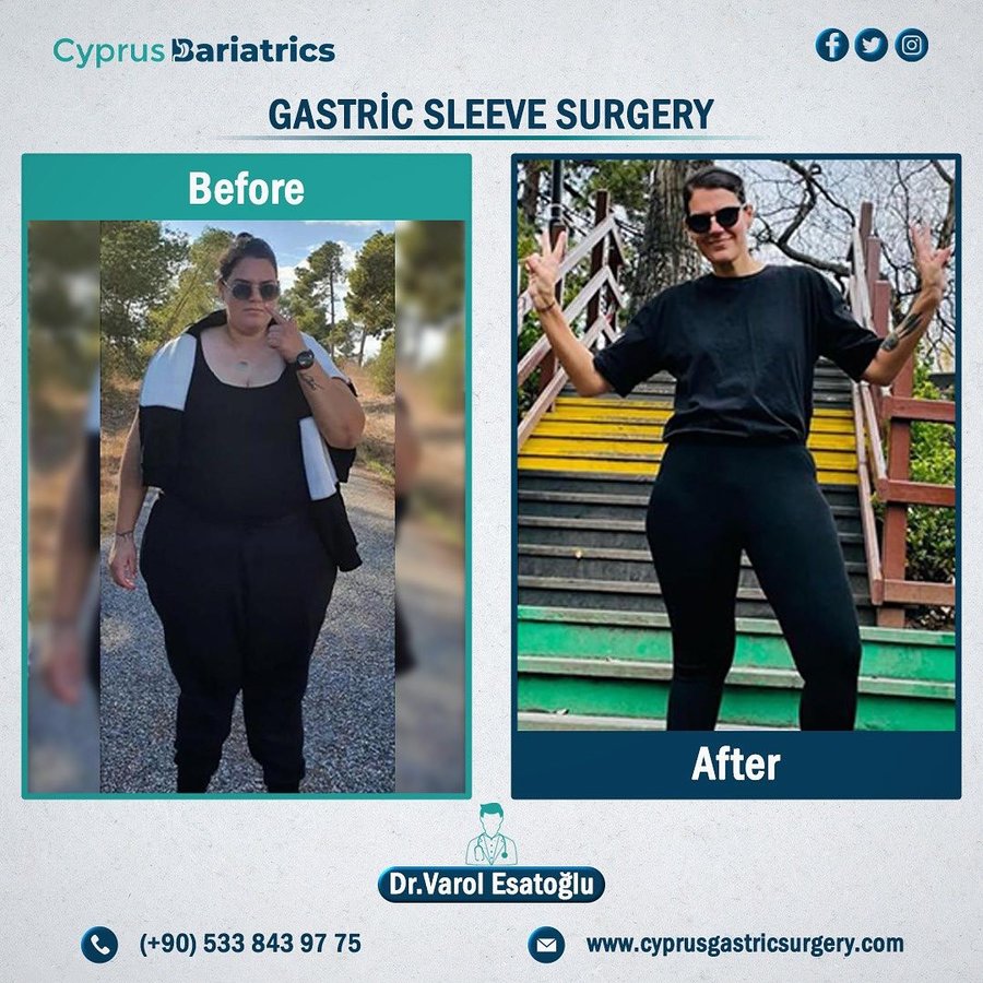 Cyprus Bariatrics - Dr. Varol Esatoglu - Cyprus Bariatrics - Dr. Varol Esatoglu