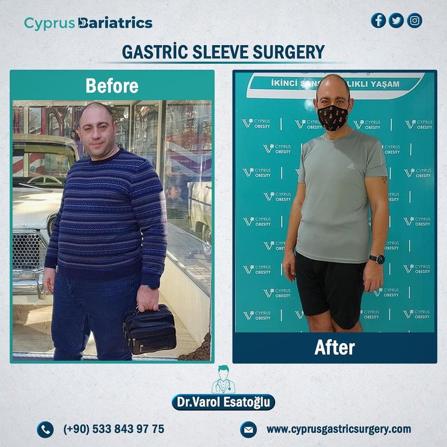Cyprus Bariatrics - Dr. Varol Esatoglu - Cyprus Bariatrics - Dr. Varol Esatoglu
