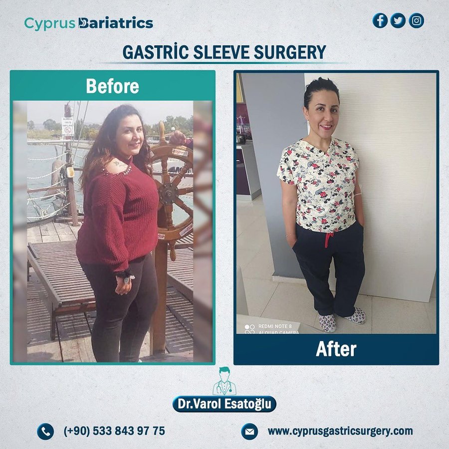 Cyprus Bariatrics - Dr. Varol Esatoglu - Cyprus Bariatrics - Dr. Varol Esatoglu