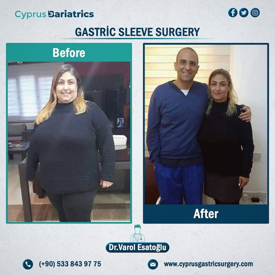 Cyprus Bariatrics - Dr. Varol Esatoglu - Cyprus Bariatrics - Dr. Varol Esatoglu