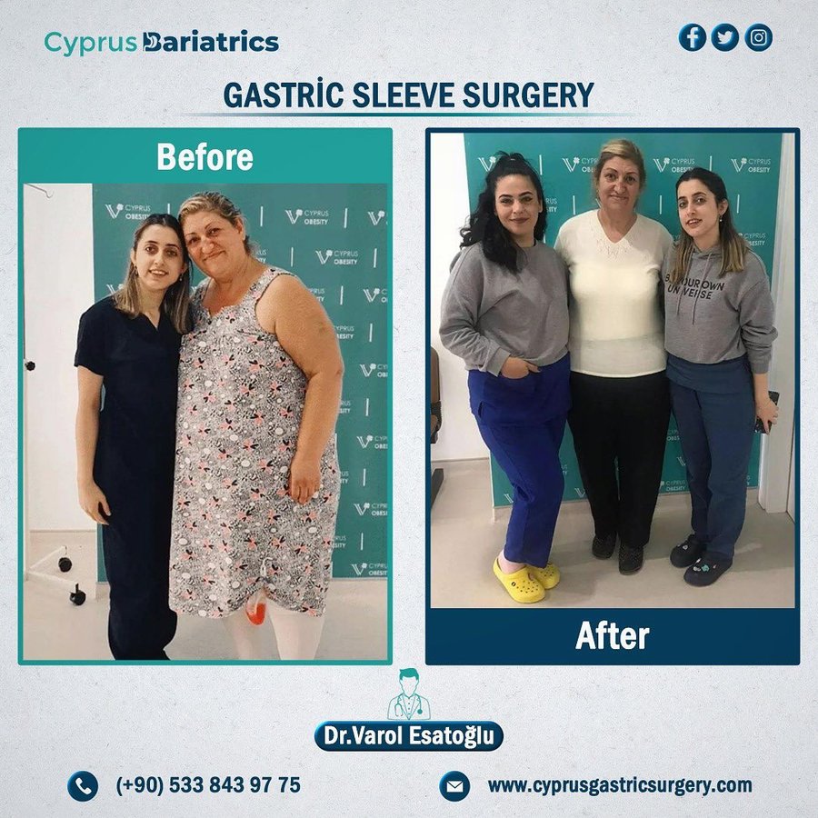 Cyprus Bariatrics - Dr. Varol Esatoglu - Cyprus Bariatrics - Dr. Varol Esatoglu