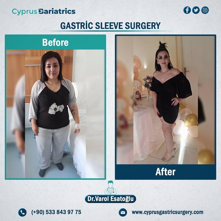 Cyprus Bariatrics - Dr. Varol Esatoglu - Cyprus Bariatrics - Dr. Varol Esatoglu