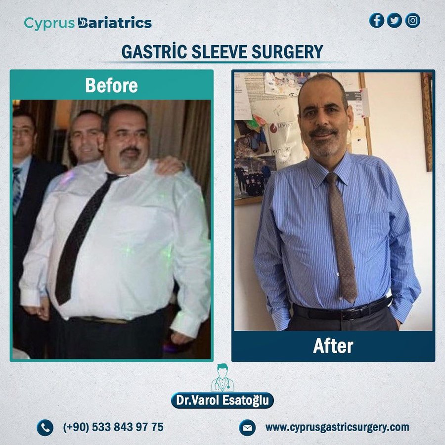 Cyprus Bariatrics - Dr. Varol Esatoglu - Cyprus Bariatrics - Dr. Varol Esatoglu