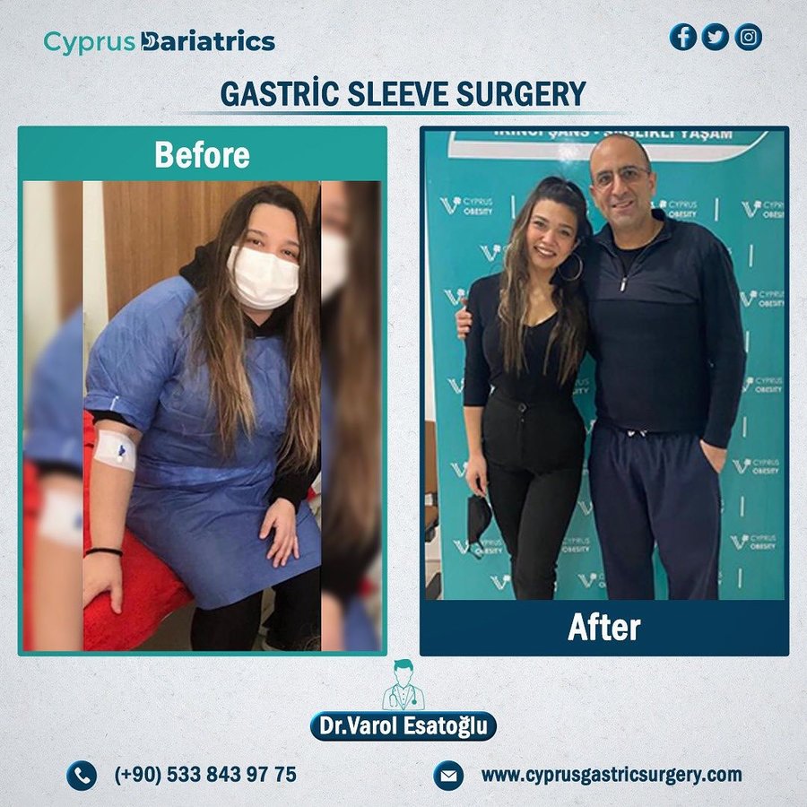 Cyprus Bariatrics - Dr. Varol Esatoglu - Cyprus Bariatrics - Dr. Varol Esatoglu
