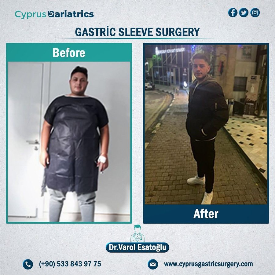Cyprus Bariatrics - Dr. Varol Esatoglu - Cyprus Bariatrics - Dr. Varol Esatoglu