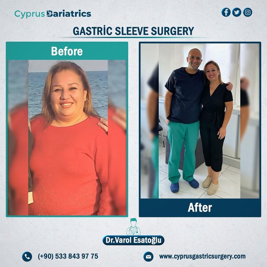 Cyprus Bariatrics - Dr. Varol Esatoglu - Cyprus Bariatrics - Dr. Varol Esatoglu