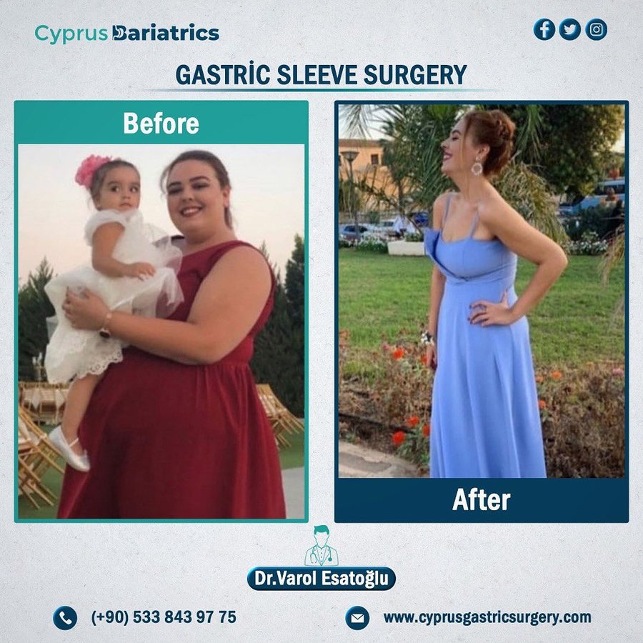 Cyprus Bariatrics - Dr. Varol Esatoglu - Cyprus Bariatrics - Dr. Varol Esatoglu