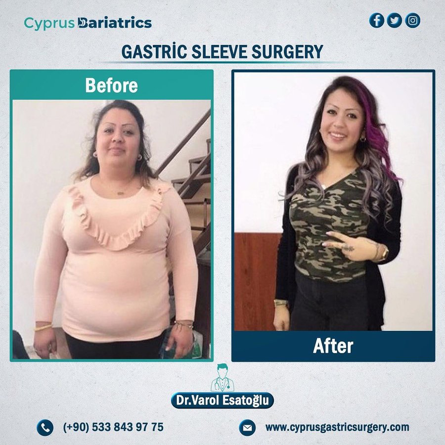 Cyprus Bariatrics - Dr. Varol Esatoglu - Cyprus Bariatrics - Dr. Varol Esatoglu