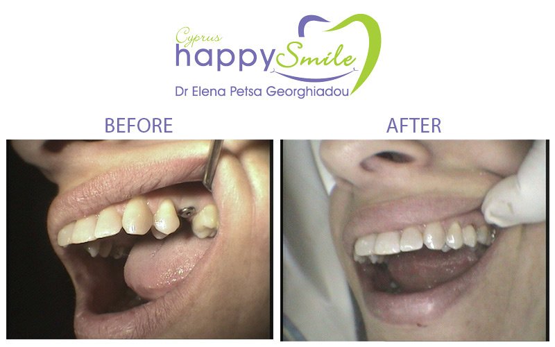 Cyprus Happy Smile - Cyprus Happy Smile