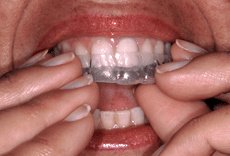 Cyprus Happy Smile - Cyprus Happy Smile