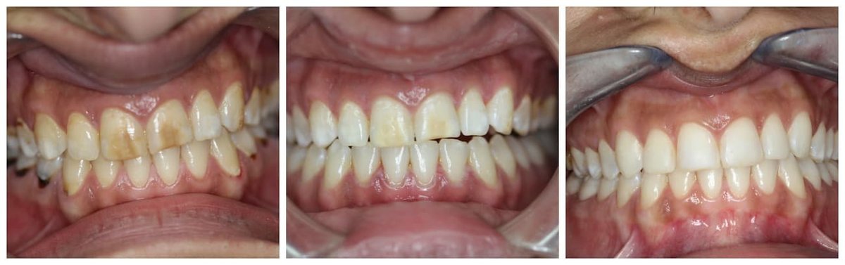 Cyprus Happy Smile - Cyprus Happy Smile