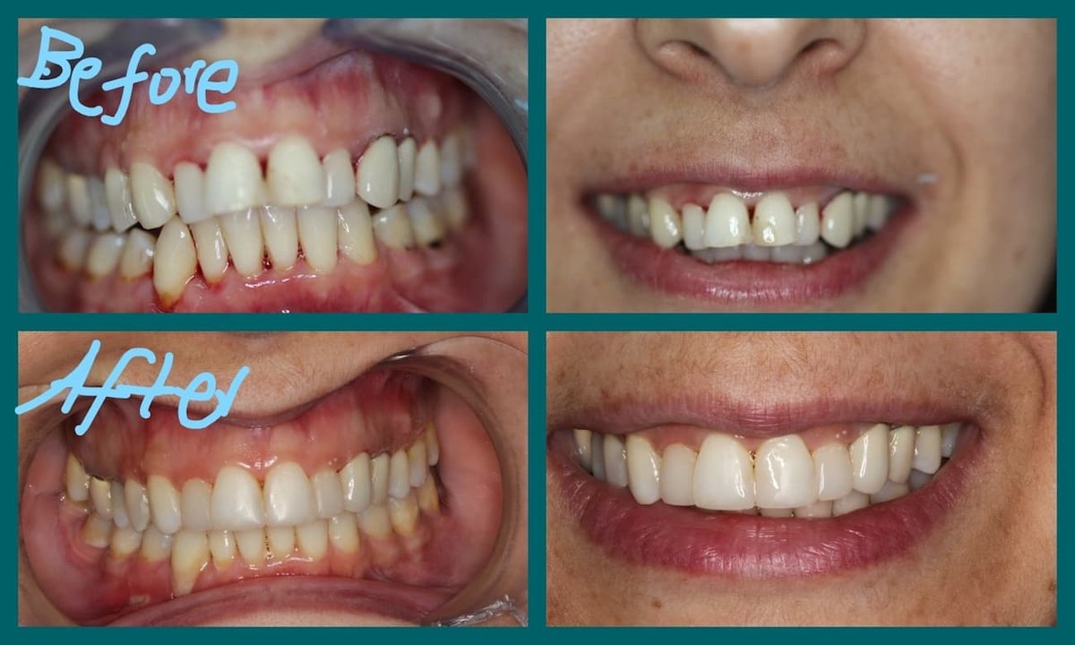 Cyprus Happy Smile - Cyprus Happy Smile