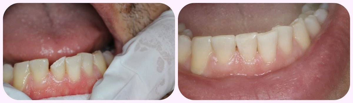 Cyprus Happy Smile - Cyprus Happy Smile