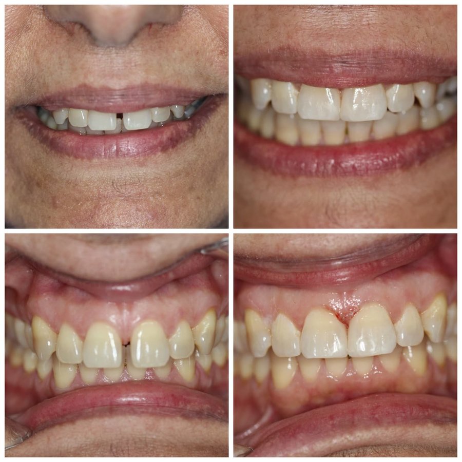 Cyprus Happy Smile - Cyprus Happy Smile