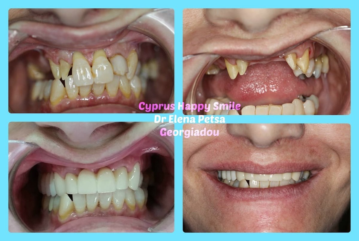 Cyprus Happy Smile - Cyprus Happy Smile