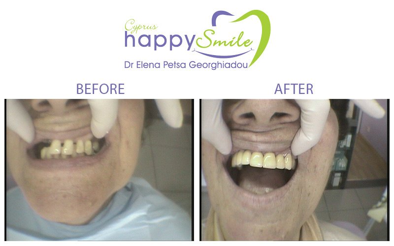 Cyprus Happy Smile - Cyprus Happy Smile