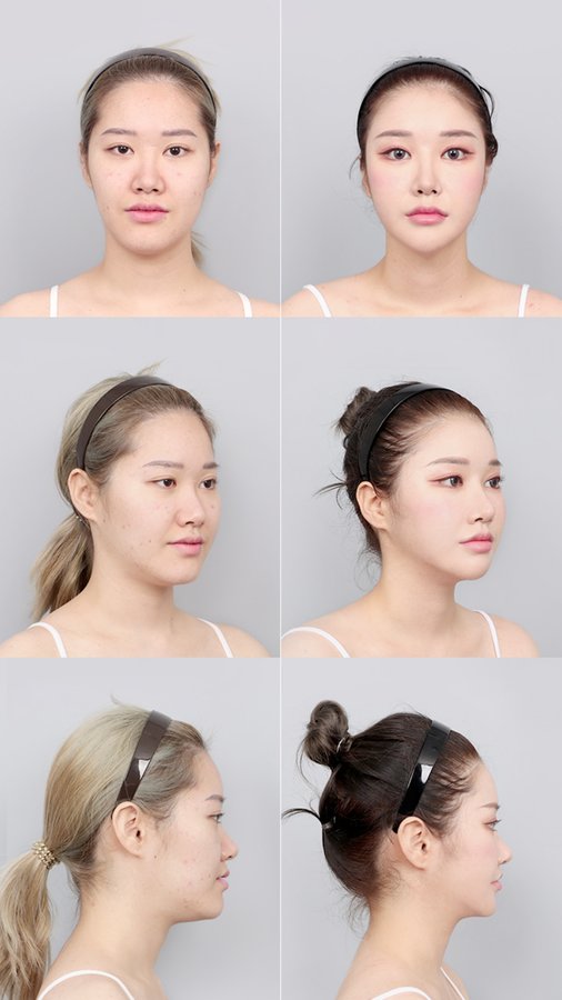 DA Plastic Surgery Clinic Korea - DA Plastic Surgery Clinic Korea