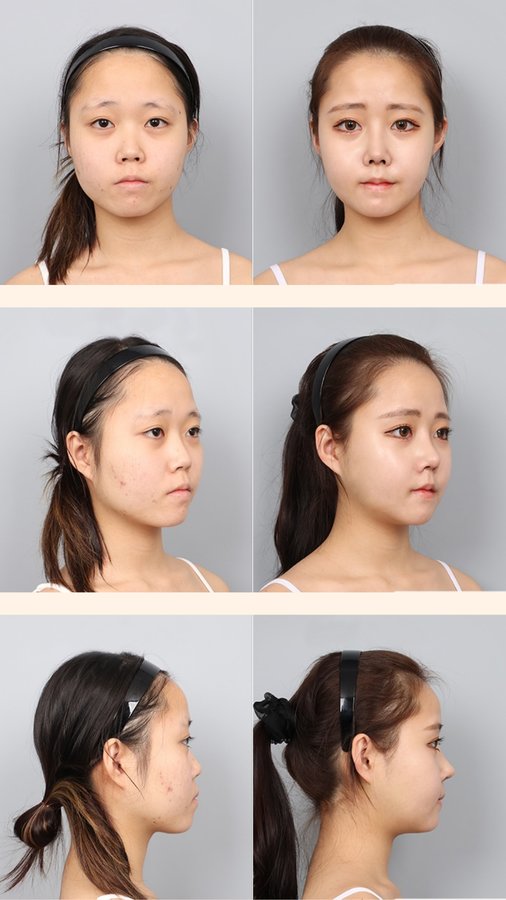 DA Plastic Surgery Clinic Korea - DA Plastic Surgery Clinic Korea