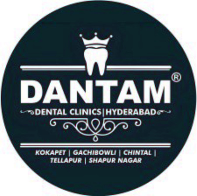 Dantam Dental - Best Dental Clinic in Kondapur - Dantam Dental - Best Dental Clinic in Kondapur