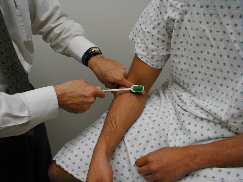 David C McKee MD Northland Neurology - David C McKee MD Northland Neurology