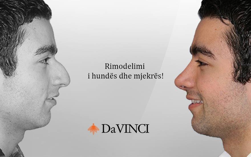 DaVinci Clinic - Prishtinë - DaVinci Clinic - Prishtinë