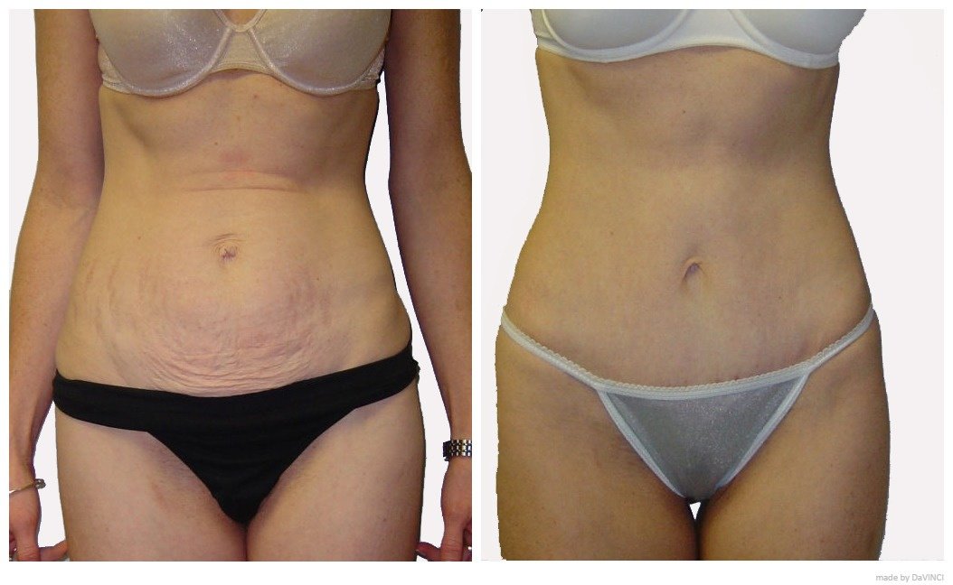 DaVinci Clinic - Prishtinë - DaVinci Clinic - Prishtinë