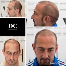 DC Micropigmentation - DC Micropigmentation