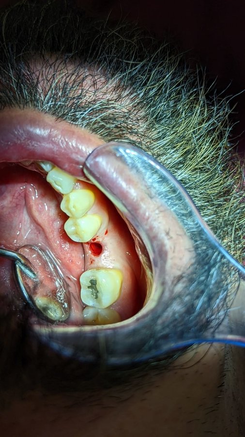 DDS Trejo Dental Clinic ,Doctor Tito - DDS Trejo Dental Clinic ,Doctor Tito