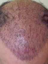 عيادة دينسغيت - Deansgate Clinic